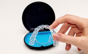 Clear Aligners