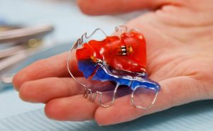 Expanders